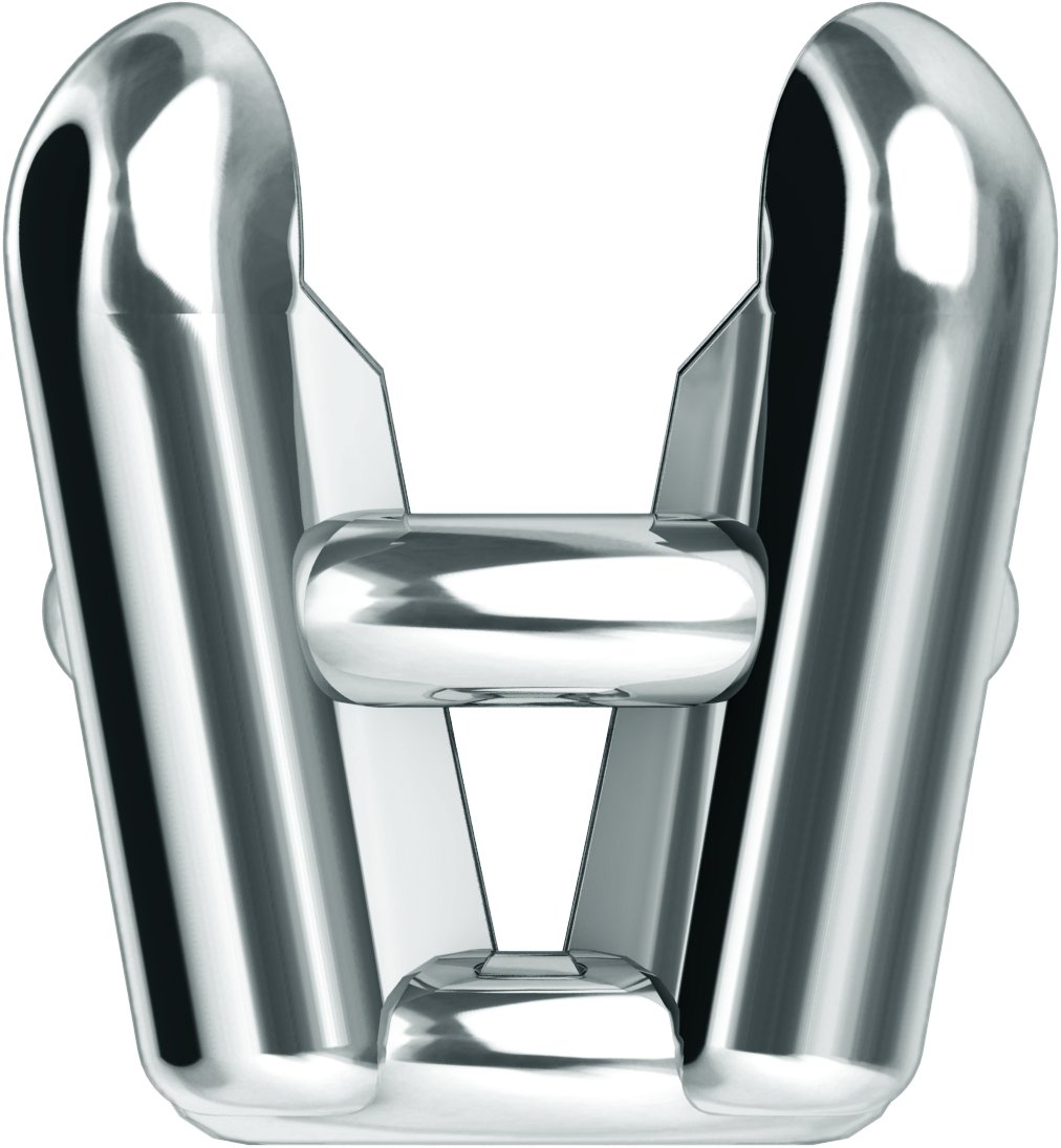 Pre-Notched Claw-Prong Basket Setting