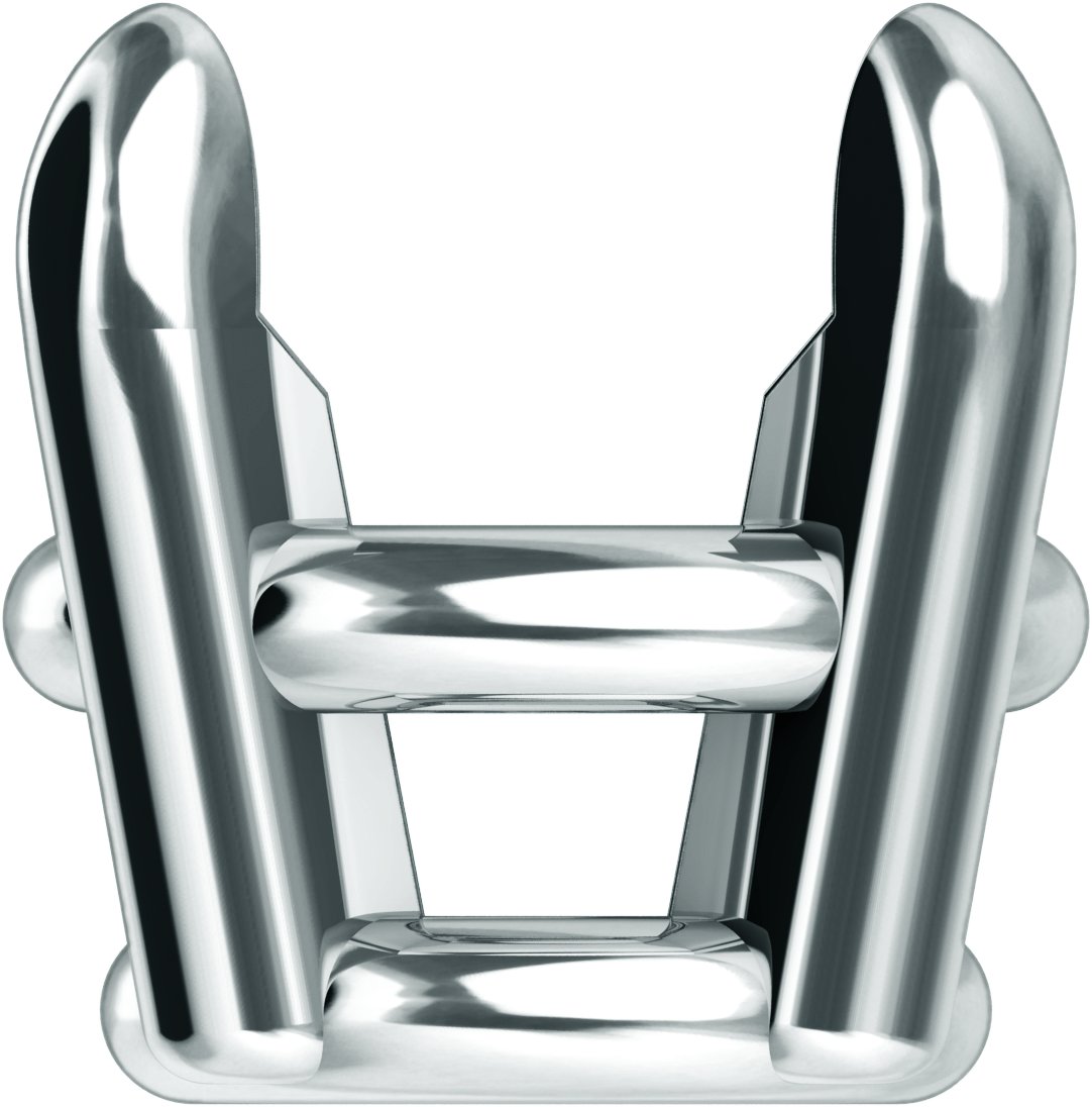 Pre-Notched Claw-Prong Basket Setting