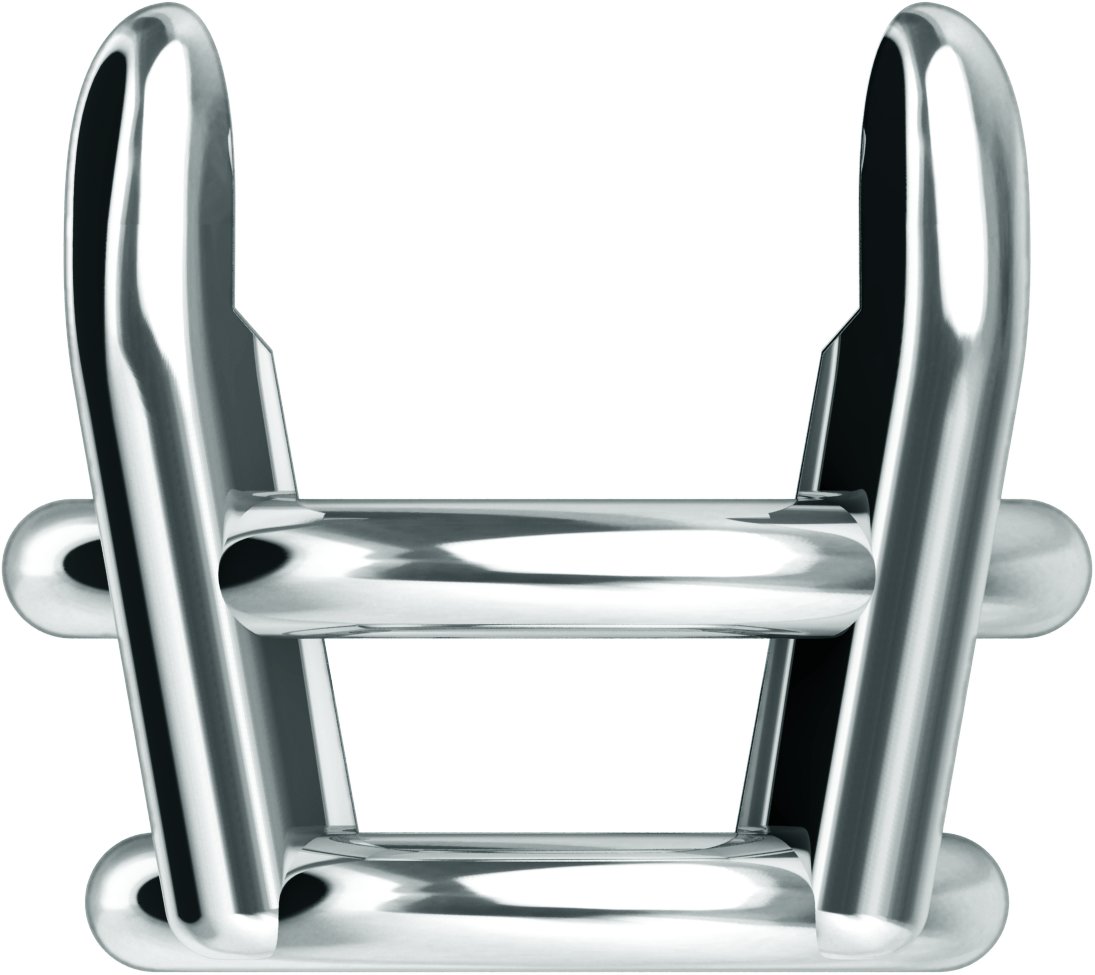Pre-Notched Claw-Prong Basket Setting