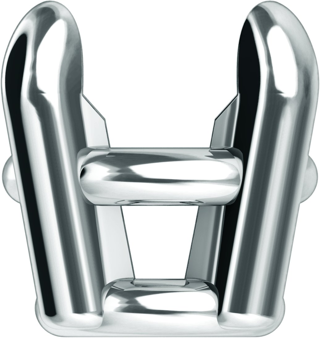Pre-Notched Claw-Prong Basket Setting